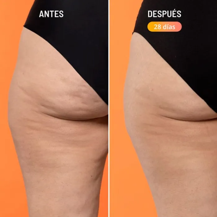 Freshly Cosmetics Beta-Burner Sculpting Treatment