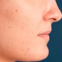 Freshly Cosmetics Blue Radiance Enzymatic Serum