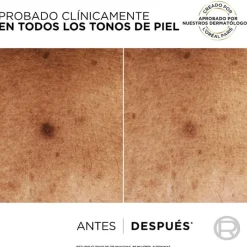 L'Oréal Bright Reveal Sérum Anti-Manchas