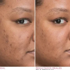 IT COSMETICS Bye Bye Dark Spots Concentrated Sérum