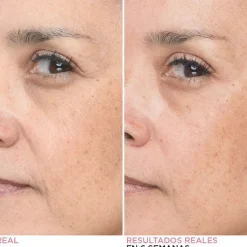 IT COSMETICS Bye Bye Lines Concentrated Sérum