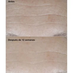 CLINIQUE Smart Clinical Repair SPF30 Wrinkle Correcting Cream