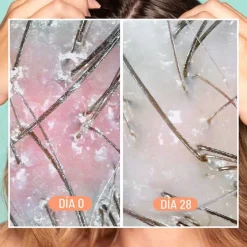 Hombre Freshly Cosmetics Dandruff & Scalp Exfoliating Treatment