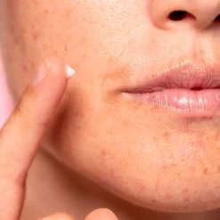 Freshly Cosmetics Lotus Radiance Dark Spot Treatment