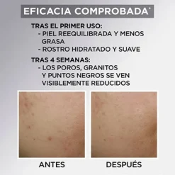 Hombre Garnier Pure Active Crema Hidratante Matificante