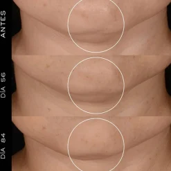 LANCÔME Rénergie H.P.N. 300-Peptide Cream