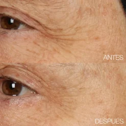 CLINIQUE Smart Clinical Repair Crema de Recuperación Nocturna + Mascarilla